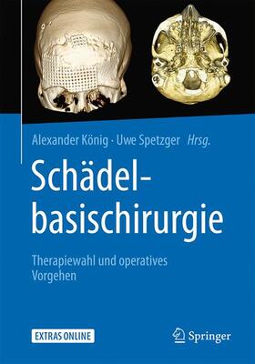 Spetzger / König |  Schädelbasischirurgie | Buch |  Sack Fachmedien