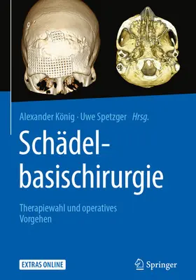 König / Spetzger |  Schädelbasischirurgie | eBook | Sack Fachmedien