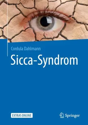 Dahlmann |  Sicca-Syndrom | Buch |  Sack Fachmedien