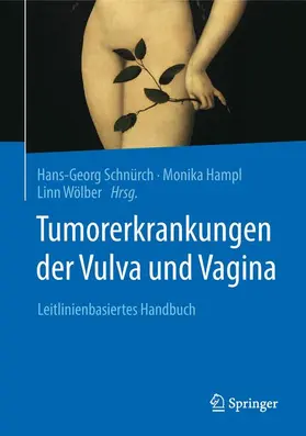 Schnürch / Hampl / Wölber |  Tumorerkrankungen der Vulva und Vagina | Buch |  Sack Fachmedien