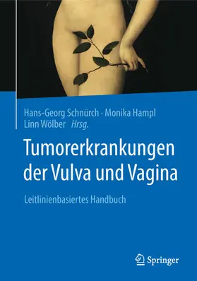 Schnürch / Hampl / Wölber |  Tumorerkrankungen der Vulva und Vagina | eBook | Sack Fachmedien