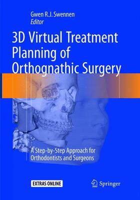 Swennen | 3D Virtual Treatment Planning of Orthognathic Surgery | Buch | 978-3-662-56896-5 | sack.de