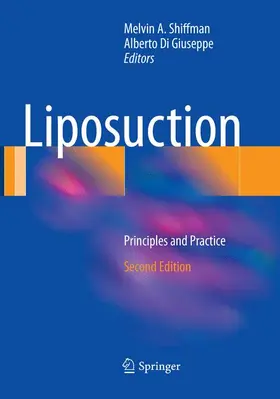 Di Giuseppe / Shiffman |  Liposuction | Buch |  Sack Fachmedien