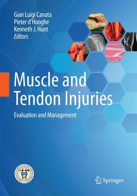 Canata / Hunt / d'Hooghe |  Muscle and Tendon Injuries | Buch |  Sack Fachmedien