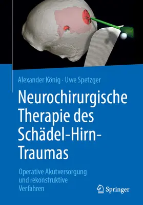 König / Spetzger |  Neurochirurgische Therapie des Schädel-Hirn-Traumas | eBook | Sack Fachmedien