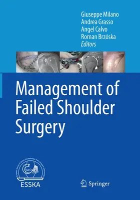 Milano / Brzóska / Grasso |  Management of Failed Shoulder Surgery | Buch |  Sack Fachmedien