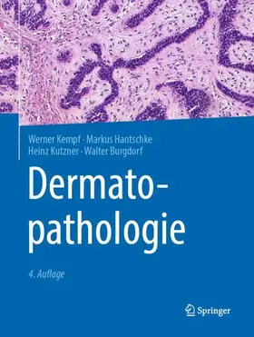 Kempf / Hantschke / Kutzner |  Dermatopathologie | Buch |  Sack Fachmedien