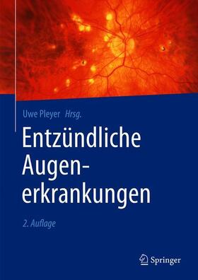 Pleyer | Entzündliche Augenerkrankungen | Buch | 978-3-662-60398-7 | sack.de