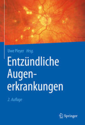 Pleyer | Entzündliche Augenerkrankungen | E-Book | sack.de