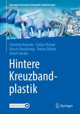 Konrads / Ahmad / Stöckle |  Hintere Kreuzbandplastik | Buch |  Sack Fachmedien