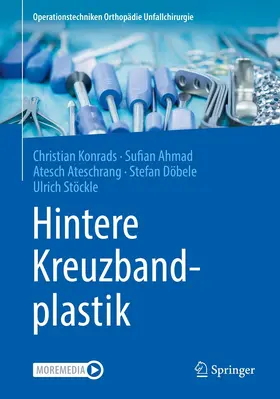 Konrads / Ahmad / Ateschrang |  Hintere Kreuzbandplastik | eBook | Sack Fachmedien