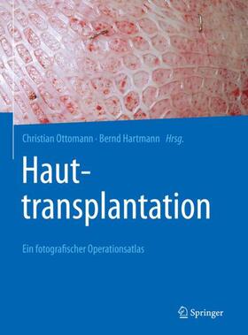 Hartmann / Ottomann |  Hauttransplantation | Buch |  Sack Fachmedien