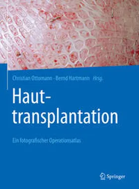 Ottomann / Hartmann |  Hauttransplantation | eBook | Sack Fachmedien