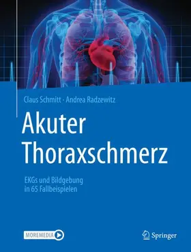 Radzewitz / Schmitt |  Akuter Thoraxschmerz | Buch |  Sack Fachmedien