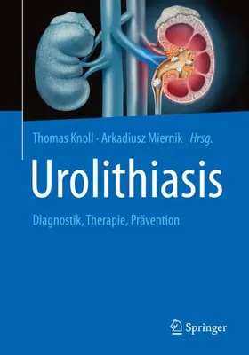 Knoll / Miernik |  Urolithiasis | Buch |  Sack Fachmedien