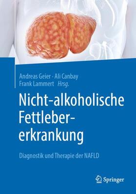 Geier / Lammert / Canbay |  Nicht-alkoholische Fettlebererkrankung | Buch |  Sack Fachmedien