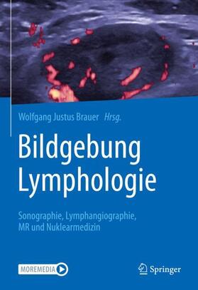 Brauer |  Bildgebung Lymphologie | Buch |  Sack Fachmedien