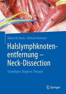 Hermann / Erovic |  Halslymphknotenentfernung ¿ Neck-Dissection | Buch |  Sack Fachmedien