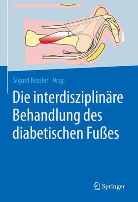 Kessler |  Die interdisziplinäre Behandlung des diabetischen Fußes | Buch |  Sack Fachmedien