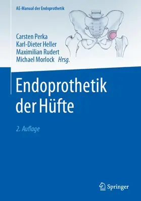 Perka / Morlock / Heller |  Endoprothetik der Hüfte | Buch |  Sack Fachmedien