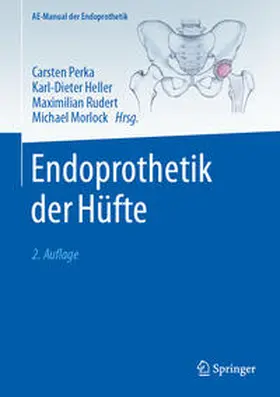 Perka / Heller / Rudert |  Endoprothetik der Hüfte | eBook | Sack Fachmedien