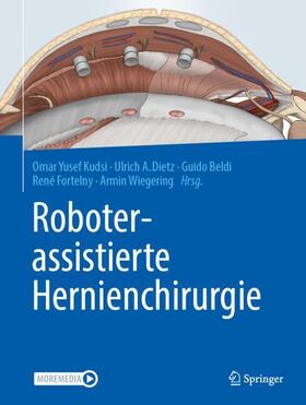 Kudsi / Dietz / Beldi |  Roboterassistierte Hernienchirurgie | Buch |  Sack Fachmedien