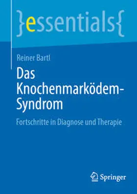 Bartl |  Das Knochenmarködem-Syndrom | eBook | Sack Fachmedien