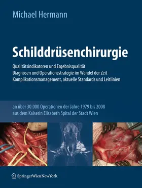 Hermann |  Schilddrüsenchirurgie - Qualitätsindikatoren und Ergebnisqualität, Diagnosen und Operationsstrategie im Wandel der Zeit, Komplikationsmanagement, aktuelle Standards und Leitlinien | Buch |  Sack Fachmedien