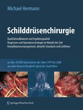 Hermann |  Schilddrüsenchirurgie - Qualitätsindikatoren und Ergebnisqualität, Diagnosen und Operationsstrategie im Wandel der Zeit, Komplikationsmanagement, aktuelle Standards und Leitlinien | eBook | Sack Fachmedien