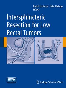 Metzger / Schiessel |  Intersphincteric Resection for Low Rectal Tumors | Buch |  Sack Fachmedien
