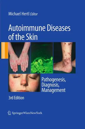 Hertl |  Autoimmune Diseases of the Skin | Buch |  Sack Fachmedien