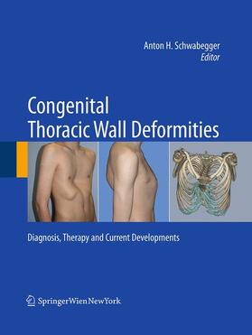 Schwabegger |  Congenital Thoracic Wall Deformities | Buch |  Sack Fachmedien