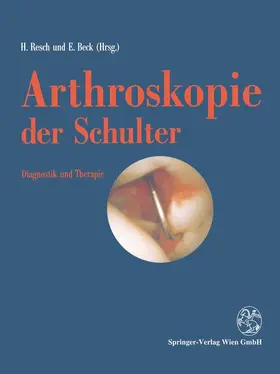 Beck / Resch |  Arthroskopie der Schulter | Buch |  Sack Fachmedien