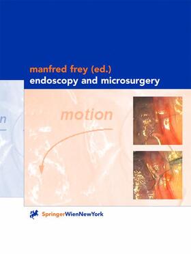 Frey |  Endoscopy and Microsurgery | Buch |  Sack Fachmedien