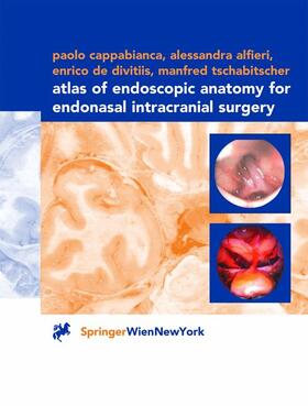Cappabianca / Tschabitscher / Alfieri |  Atlas of Endoscopic Anatomy for Endonasal Intracranial Surgery | Buch |  Sack Fachmedien