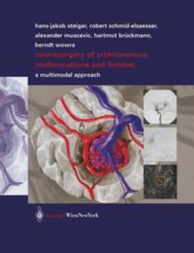 Schmid-Elsaesser / Muacevic / Brückmann |  Neurosurgery of Arteriovenous Malformations and Fistulas | Buch |  Sack Fachmedien