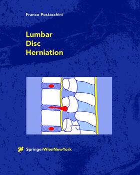 Postacchini |  Lumbar Disc Herniation | Buch |  Sack Fachmedien