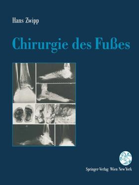 Zwipp |  Chirurgie des Fußes | Buch |  Sack Fachmedien