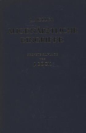 Meller |  Augenärztliche Eingriffe | Buch |  Sack Fachmedien