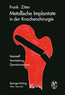 Zitter / Frank |  Metallische Implantate in der Knochenchirurgie | Buch |  Sack Fachmedien