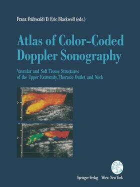 Blackwell / Frühwald |  Atlas of Color-Coded Doppler Sonography | Buch |  Sack Fachmedien
