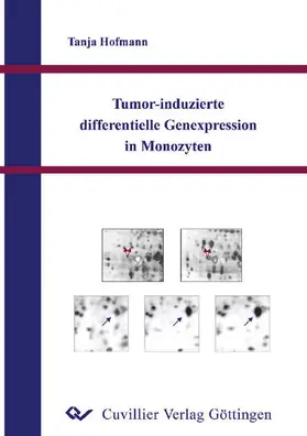 Hofmann |  Tumor-induzierte differentielle Genexpression in Monozyten | eBook | Sack Fachmedien