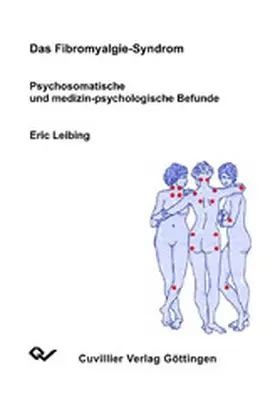 Leibing |  Das Fibromyalgie-Syndrom | eBook | Sack Fachmedien