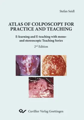 Seidl |  Atlas of Colposcopy for Practice and Teaching | eBook | Sack Fachmedien