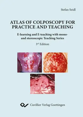 Seidl |  Atlas of Colposcopy for Practice and Teaching | eBook | Sack Fachmedien