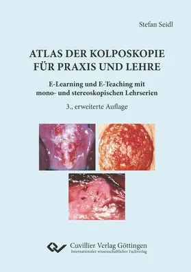 Seidl |  Atlas der Kolposkopie für Praxis und Lehre | eBook | Sack Fachmedien