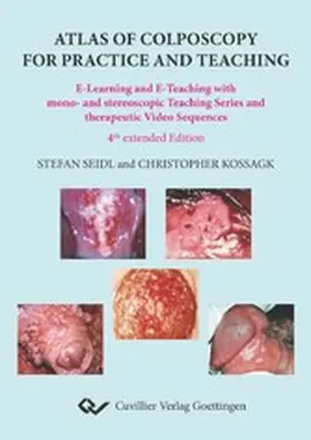 Koßagk |  Atlas of Colposcopy for Practice and Teaching | eBook | Sack Fachmedien