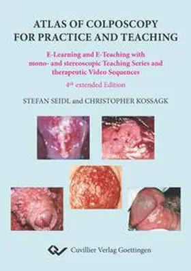 Koßagk / Seidl |  Atlas of Colposcopy for Practice and Teaching | Buch |  Sack Fachmedien