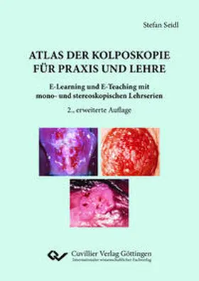 Seidl |  Atlas der Kolposkopie für Praxis und Lehre | Buch |  Sack Fachmedien