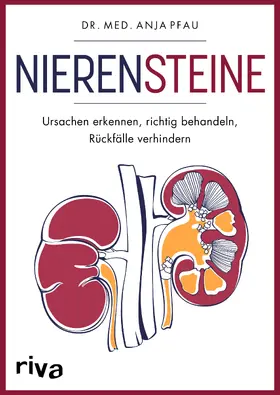 Pfau |  Nierensteine - Ursachen erkennen, richtig behandeln, Rückfälle verhindern | Buch |  Sack Fachmedien